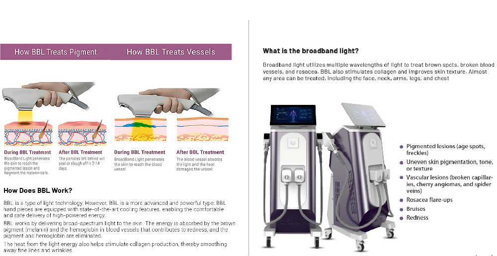DPL fastest hair removal and milk light NIR